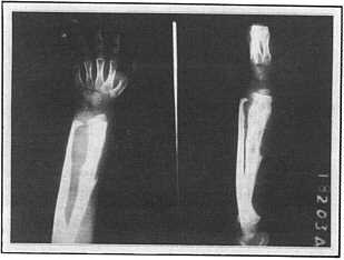 bntumor.jpg (7971 bytes)